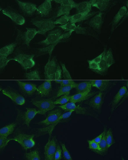 Anti-ADA Antibody (CAB1019)