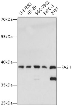 Anti-FA2H Antibody (CAB13873)