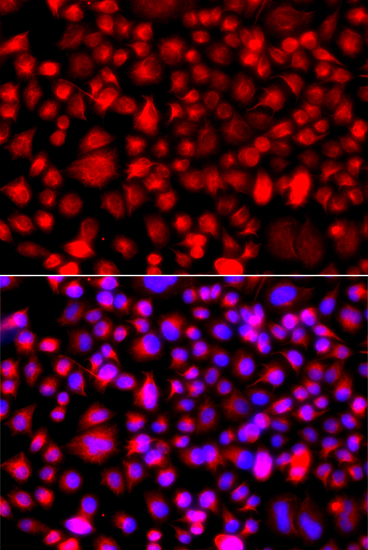 Anti-ALG1 Antibody (CAB7818)