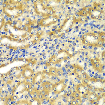 Anti-GOPC Antibody (CAB13436)