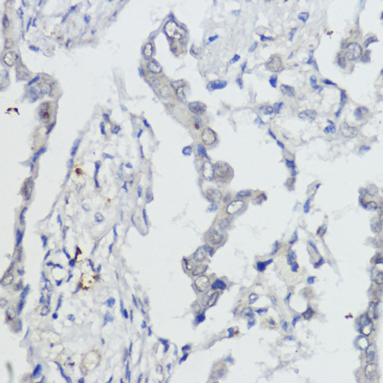 Anti-AKT1 Antibody (CAB11016)