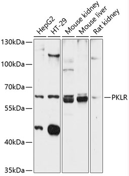 Anti-PKLR Antibody (CAB12336)