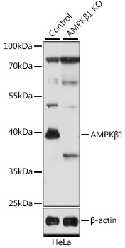 Anti-AMPKBeta1 Antibody [KO Validated] (CAB12491)