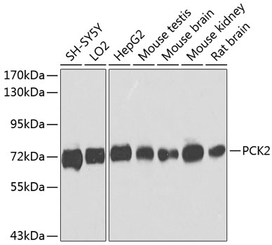 Anti-PCK2 Polyclonal Antibody (CAB8446)