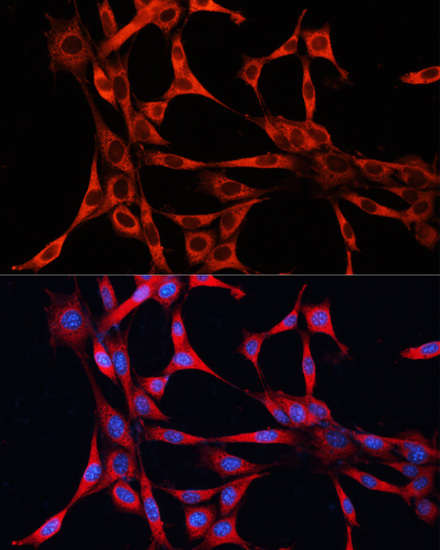 Anti-mTOR Antibody (CAB2445)