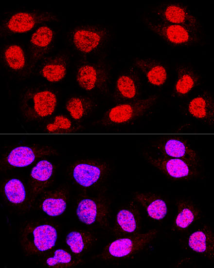 Anti-TEAD3 Antibody (CAB7454)