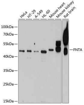 Anti-FNTA Polyclonal Antibody (CAB8805)