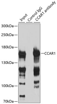 Anti-CCAR1 Antibody (CAB13595)