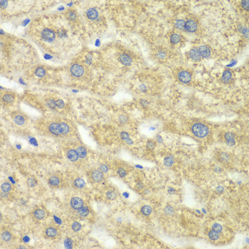 Anti-DLD Antibody (CAB13296)