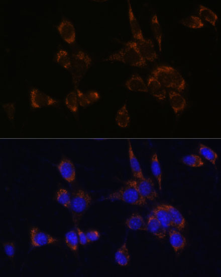 Anti-Perforin Antibody (CAB0093)