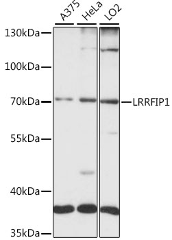 Anti-LRRFIP1 Antibody (CAB15752)