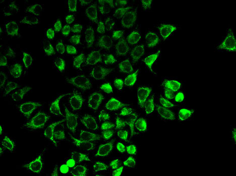 Anti-PRL Antibody (CAB1618)