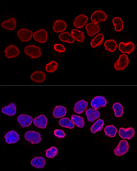 Anti-Lamin B1 Antibody (CAB16909)