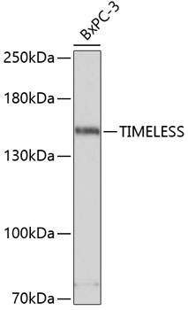 Anti-TIMELESS Antibody (CAB4261)