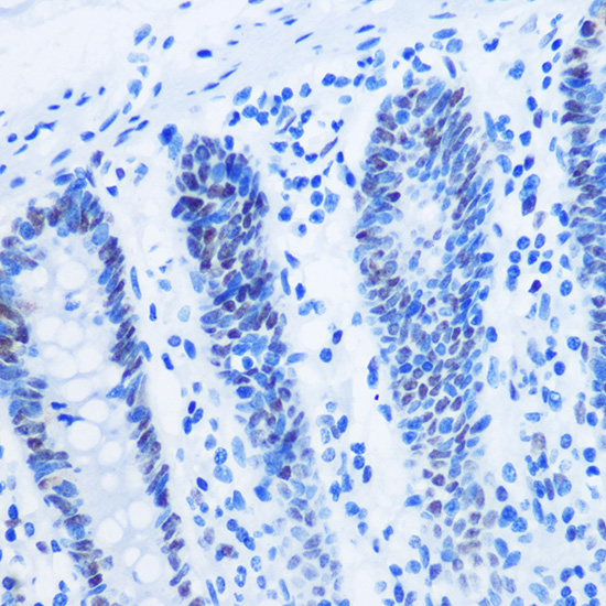 Anti-Asymmetric DiMethyl-Histone H3-R8 Antibody (CAB3157)