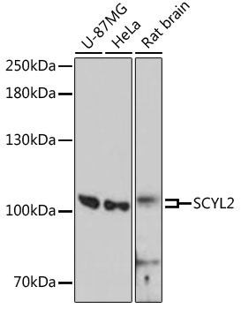 Anti-SCYL2 Antibody (CAB13179)