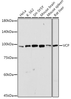 Anti-VCP Antibody (CAB13368)