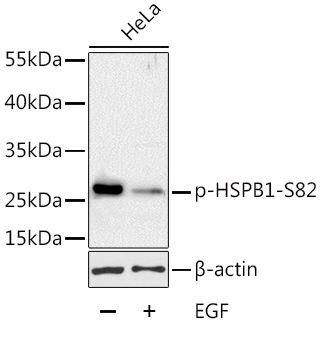 Anti-Phospho-HSPB1-S82 Antibody (CABP0041)