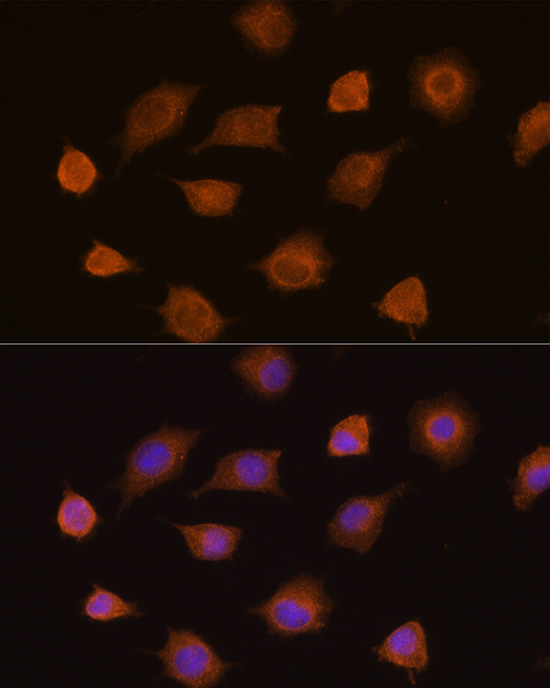 Anti-PKM Antibody (CAB13905)