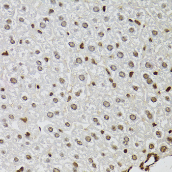 Anti-KDM4A Polyclonal Antibody (CAB7953)