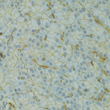 Anti-KCNJ1 Polyclonal Antibody (CAB8554)