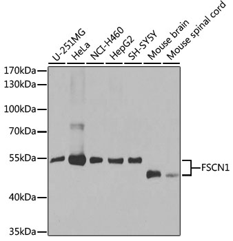 Anti-FSCN1 Antibody [KO Validated] (CAB1904)