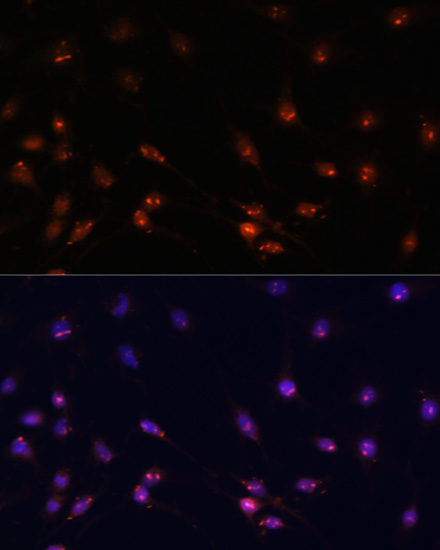 Anti-ATR Antibody (CAB17294)