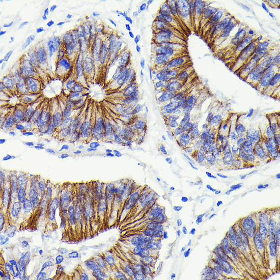 Anti-Beta-Catenin Antibody [KO Validated] (CAB19657)