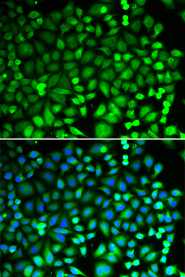 Anti-PSMB2 Antibody (CAB13630)