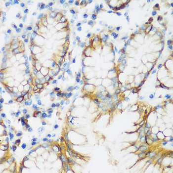 Anti-E-Cadherin Antibody (CAB11492)