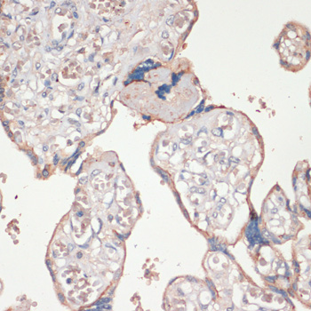 Anti-ASC / TMS1 Antibody (CAB16672)