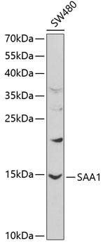 Anti-SAA1 Antibody (CAB1655)