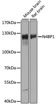 Anti-N4BP1 Antibody