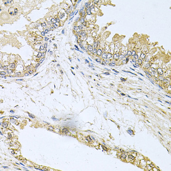 Anti-BCR Antibody (CAB0068)