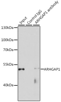 Anti-ARHGAP1 Antibody (CAB3739)