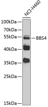 Anti-BBS4 Antibody (CAB3759)