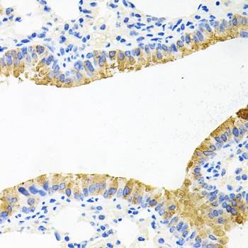 Anti-TOB2 Antibody (CAB7223)