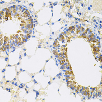 Anti-CEACAM5 Antibody (CAB12421)