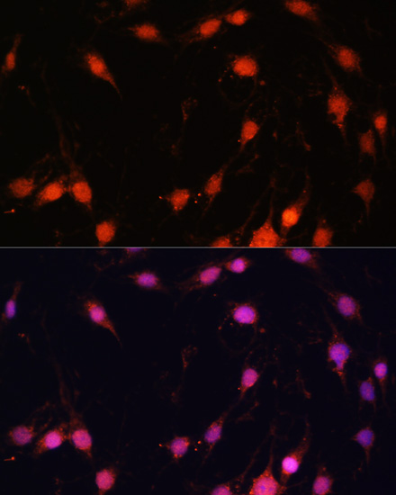 Anti-ZNF416 Antibody (CAB14910)