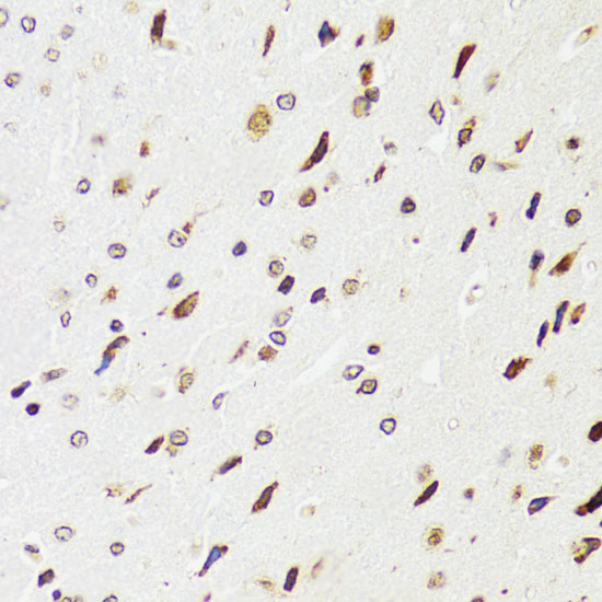 Anti-EDF1 Antibody [KO Validated] (CAB2283)