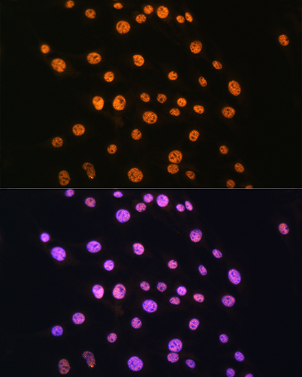 Anti-NR2F2 Antibody (CAB10251)