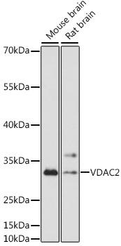 Western blot analysis of extracts of various cell lines, using VDAC2 antibody at 1:1000 dilution. Secondary antibody: HRP Goat Anti-Rabbit IgG (H+L) at 1:10000 dilution. Lysates/proteins: 25ug per lane. Blocking buffer: 3% nonfat dry milk in TBST. Detection: ECL Basic Kit. Exposure time: 60s.