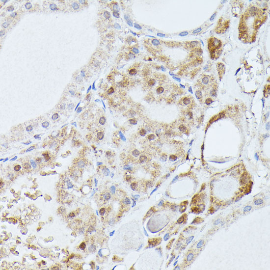 Anti-PPP2R5D Antibody (CAB15707)