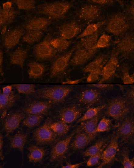 Anti-CREB3 Antibody (CAB6567)