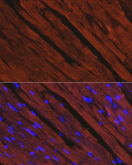 Anti-MYH6 Antibody (CAB12964)