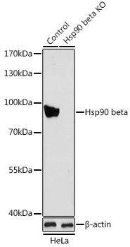 Anti-Hsp90 beta Antibody (CAB1087)