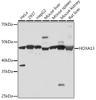 Anti-HOXA13 Antibody (CAB9564)