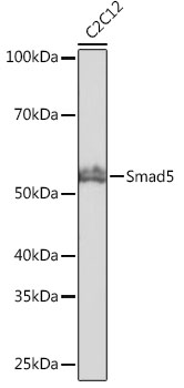 Anti-Smad5 Antibody [KO Validated] (CAB19117)