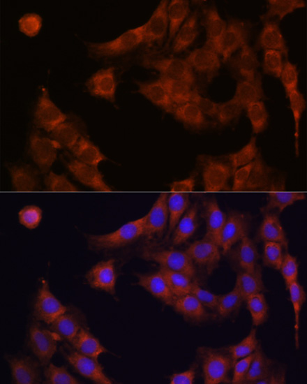 Anti-GANAB Antibody (CAB13851)