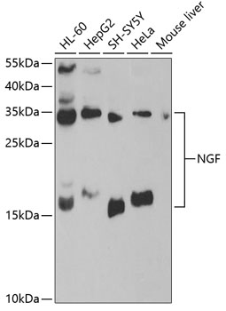 Anti-NGF Antibody (CAB0258)